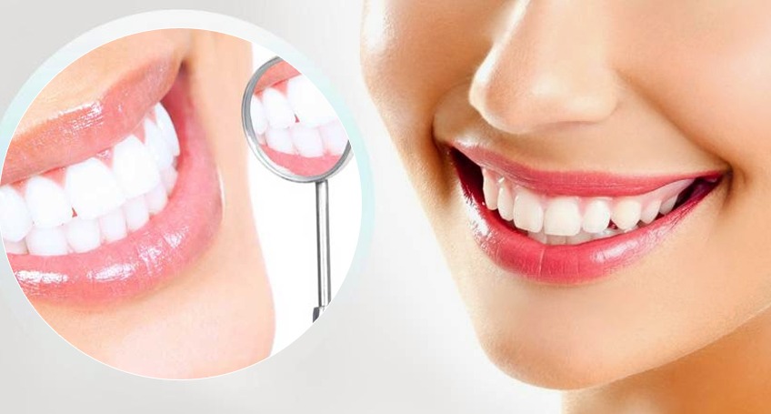 Smile designing Bangalore