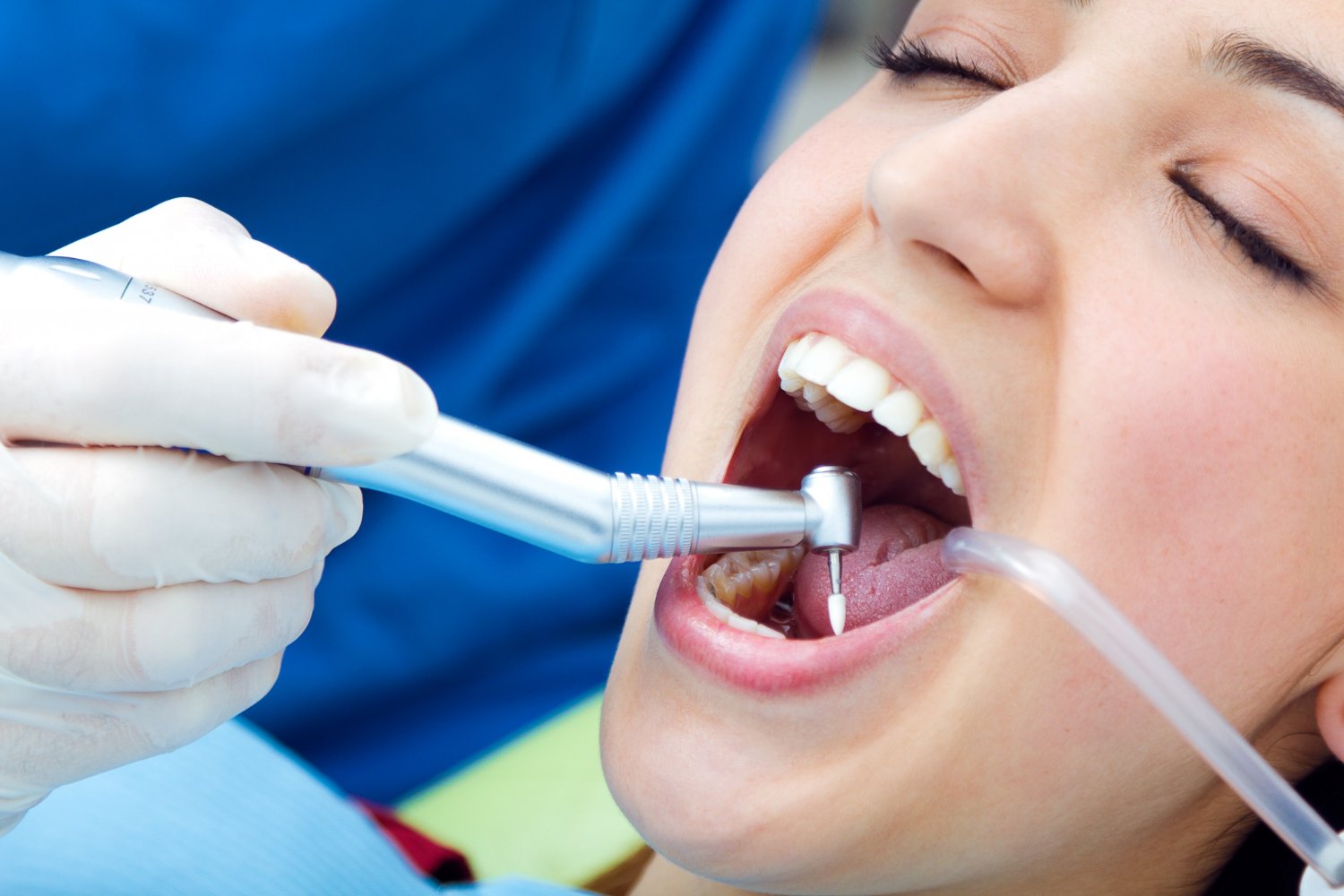 Trusted Dental Care for Root Canal Treatment in Punjagutta