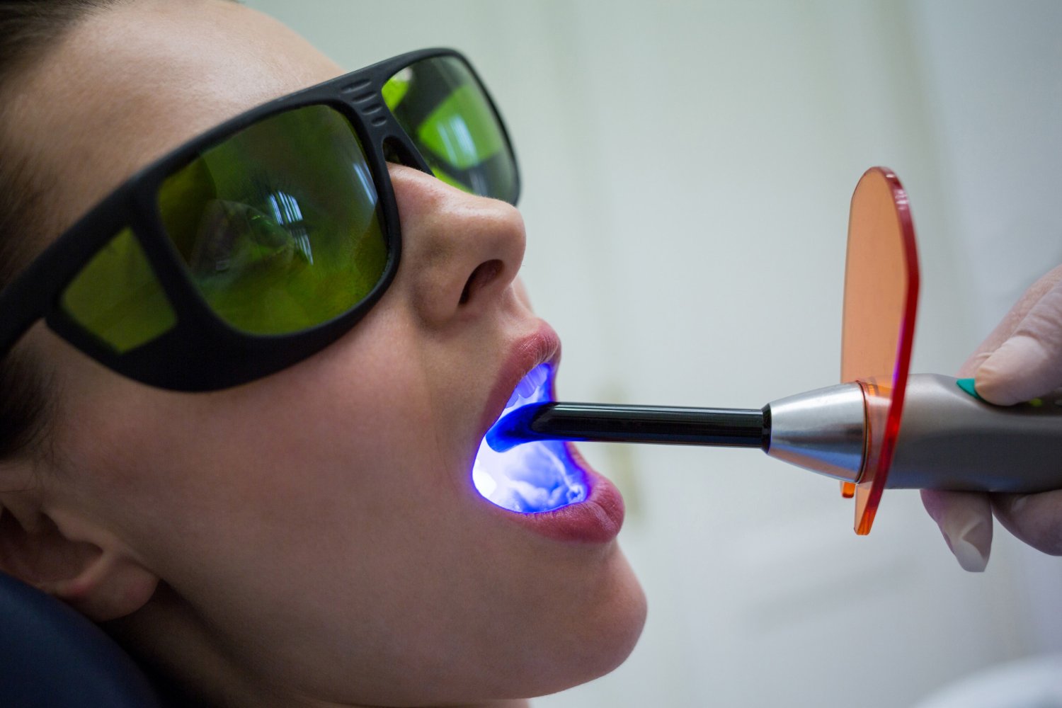 best laser dental treatment in Kompally